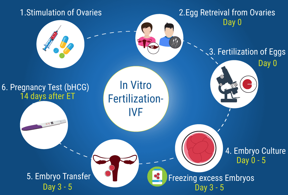 A Quick Overview about IVF