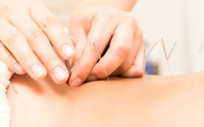 Acupuncture and Surrogacy