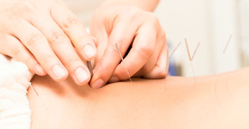 Acupuncture and Surrogacy