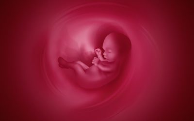 Our Placentas II – Placenta accrete