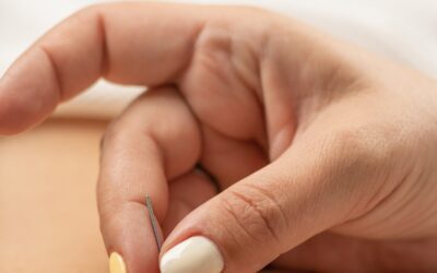 Benefits of Acupuncture for Surrogates